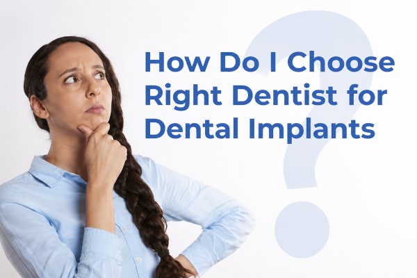 6 Points to Think While Selecting Implant Dentist