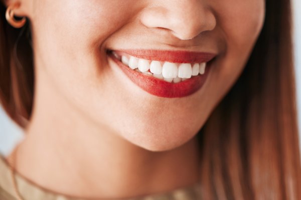 Can We Get Teeth Whitening If We Have Dentures? | Stuart