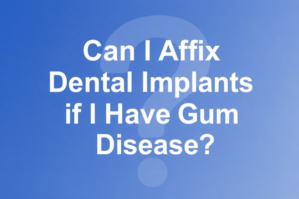Can I Affix Dental Implants if I Have Gum Disease?