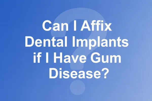 Can I Affix Dental Implants if I Have Gum Disease?