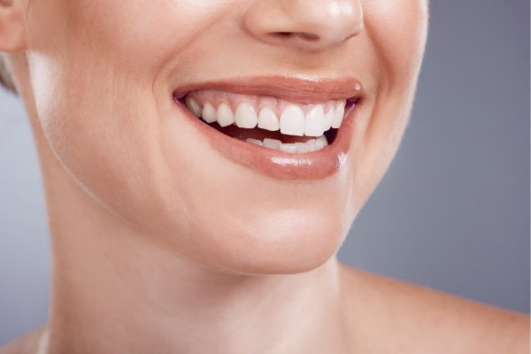 Teeth Whitening: Benefits and Procedure | Stuart, FL