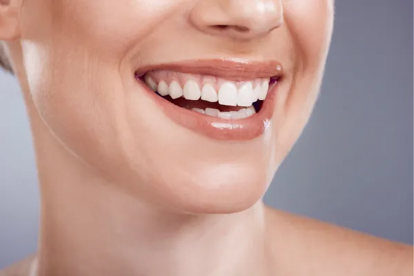 Teeth Whitening: Benefits and Procedure | Stuart, FL