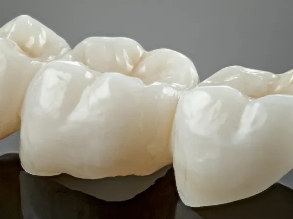 Dental Crowns